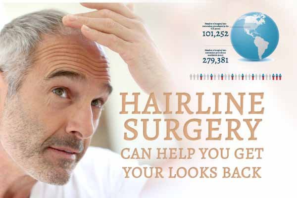 Infographic on How Hairline Surgery Can Help