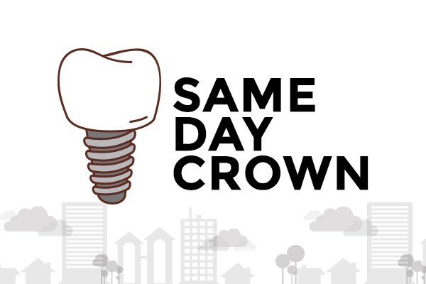 Same Day Crown Infographic